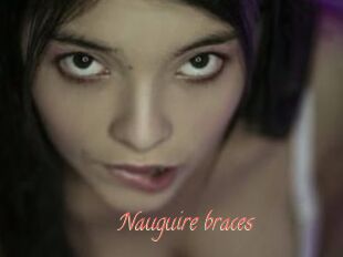 Nauguire_braces